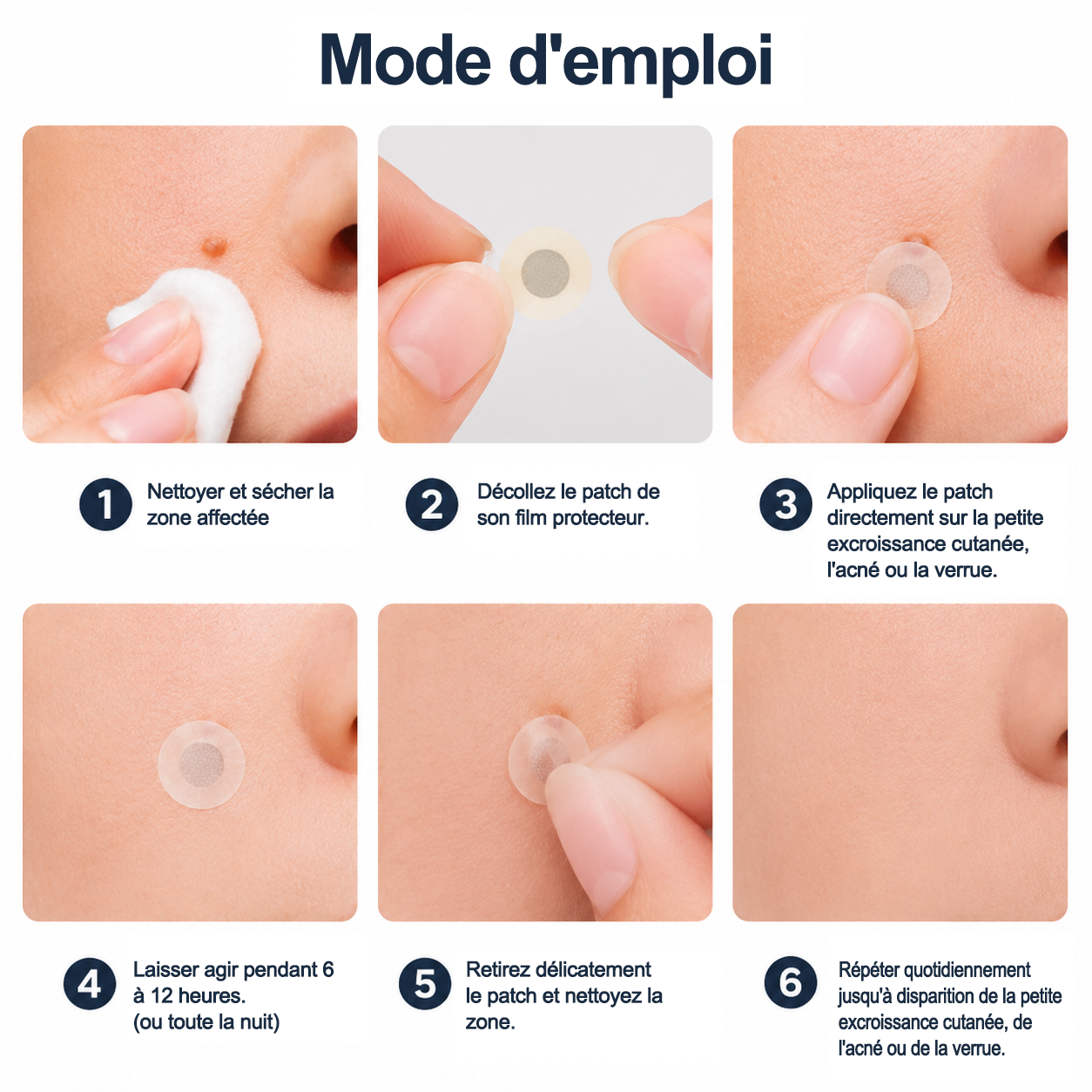 ✨Patch 2-en-1 Curalona® : Microneedle & Hydrocolloïde✨ | Élimine les grains de beauté en relief, les verrues planes et les acrochordons | Aide à atténuer les rides, les cicatrices et les imperfections | Patch invisible adapté au visage et au corps